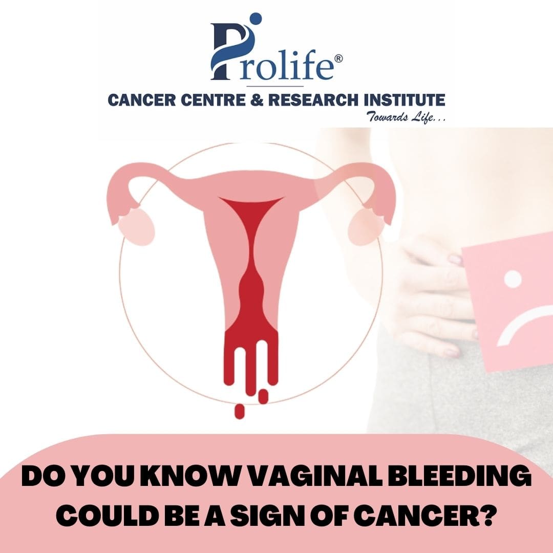 Abnormal Vaginal Bleeding Could Be A Sign Of Cancer Prolife Cancer