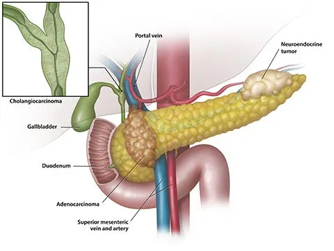pancreas