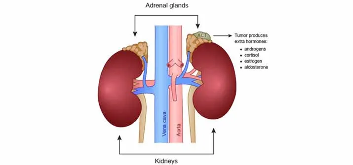 New Adrenal Cancer