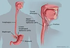 esophegeal