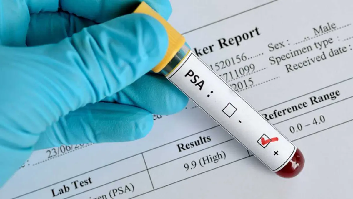 1cancer screening