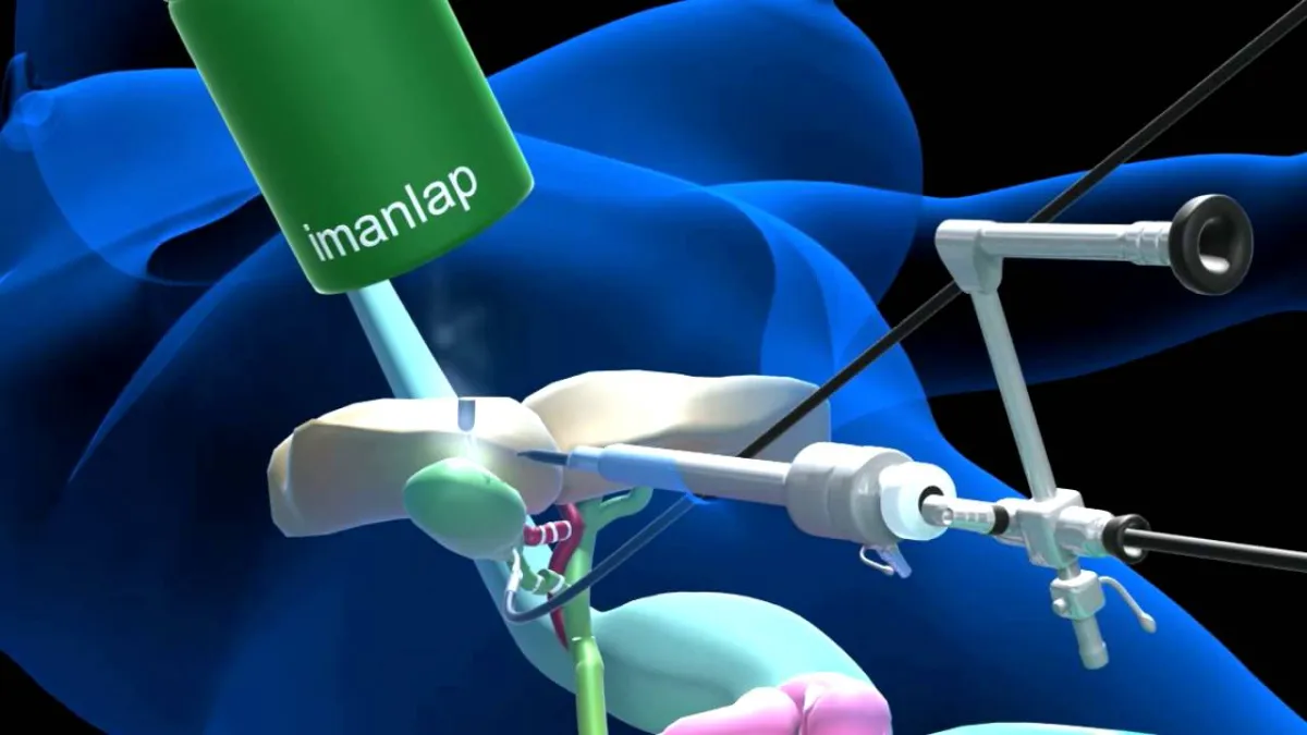 Laparoscopic
