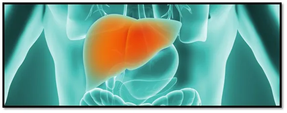 Liver cancer Liver cancer