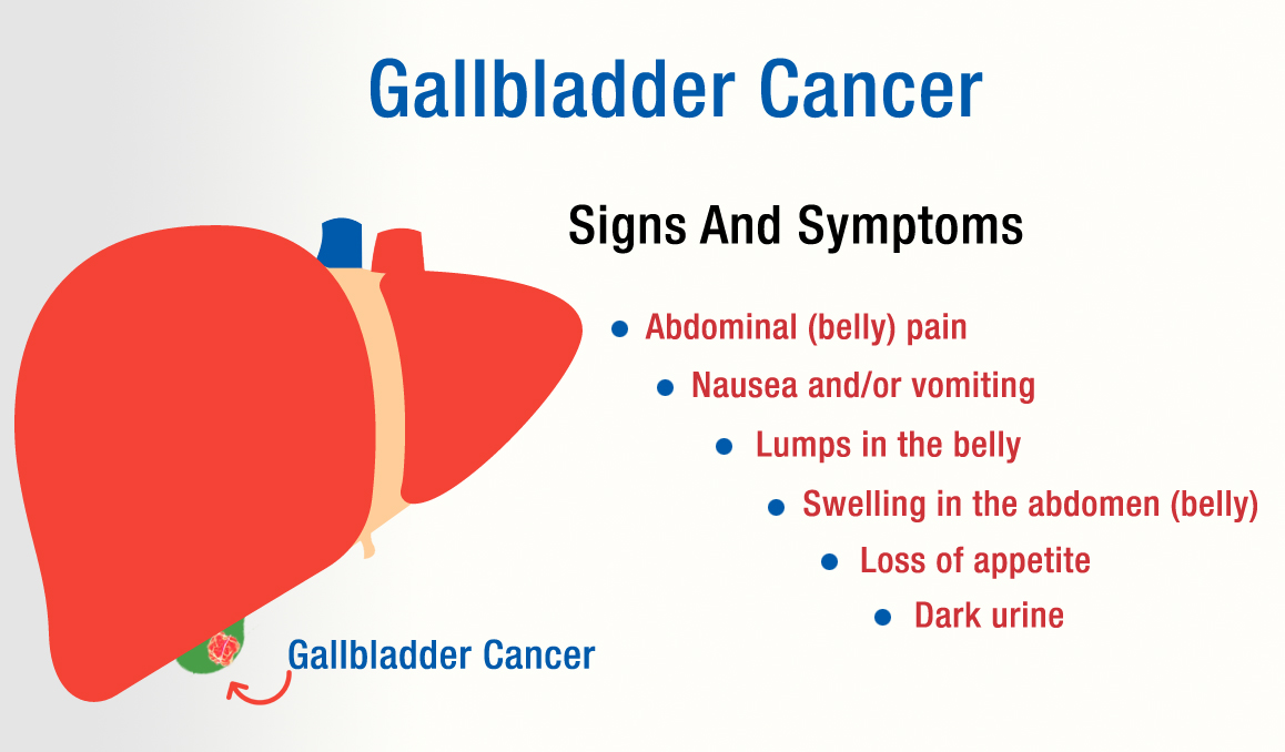 Prolife Cancer Treatment | Gallbladder Cancer Treatment in Pune | Dr ...