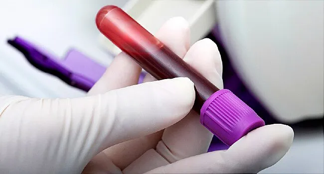 650x350 cancer prevention screening ref guide 650x350 cancer prevention screening ref guide