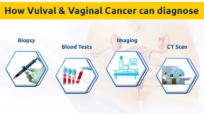 How can it be diagnosed 1 20