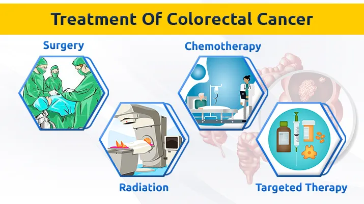 Treatment Of Colorectal Cancer Treatment Of Colorectal Cancer