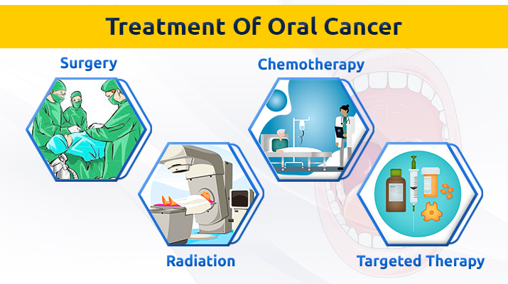 Oral Cancer Treatment In Pune Oral Cancer Surgeon In Pune