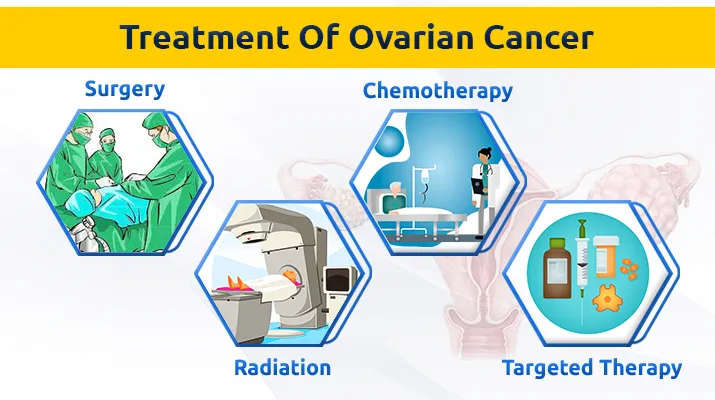 Treatment Of Ovarian Cancer