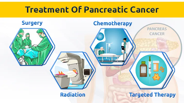 Treatment Of Pancreatic Cancer