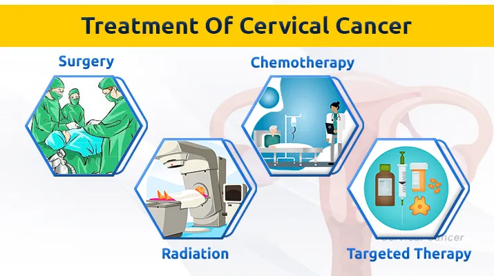 Treatment Of Pharynx Cancer 1 Treatment Of Pharynx Cancer 1