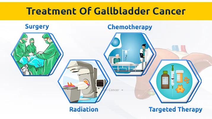 Treatment Of Pharynx Cancer 4 Treatment Of Pharynx Cancer 4