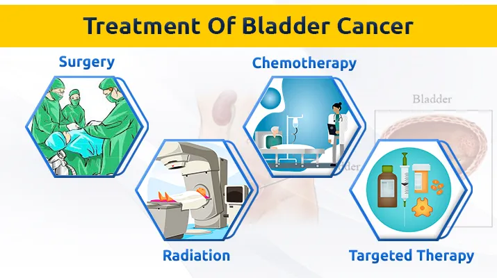 Treatment Of Pharynx Cancer Treatment Of Pharynx Cancer