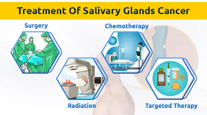 Treatment Of Salivary Glands Cancer