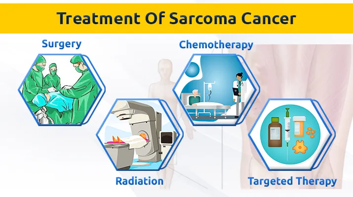 Treatment Of Sarcoma Cancer