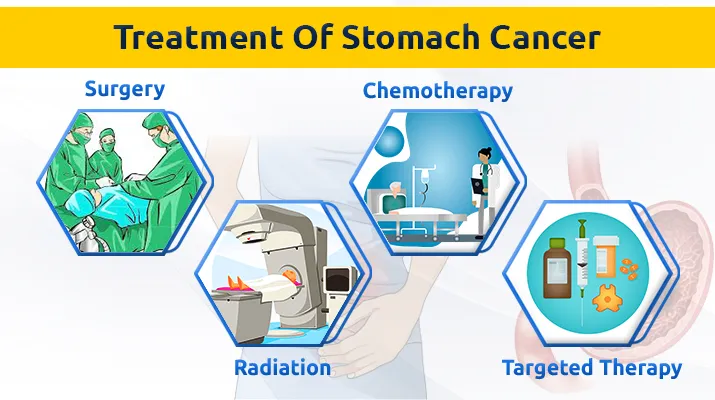 Treatment Of Stomach Cancer Treatment Of Stomach Cancer