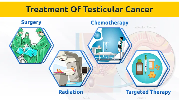 Treatment Of Testicular Cancer
