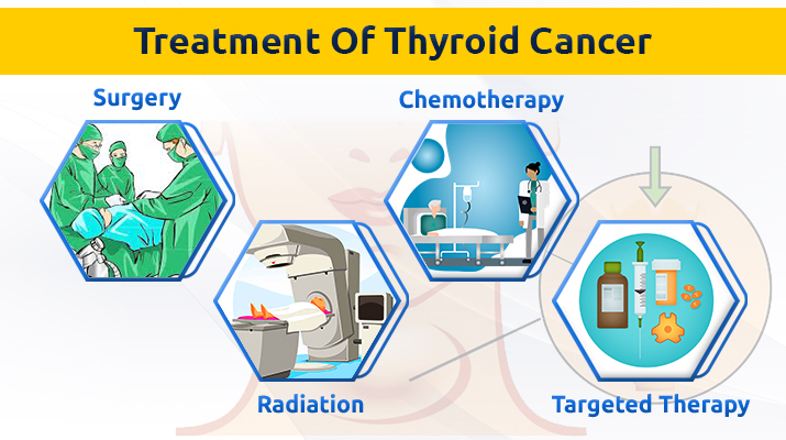 Thyroid Cancer Treatment in Pune Thyroid Cancer Clinic