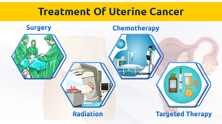 Treatment Of Uterine Cancer Treatment Of Uterine Cancer