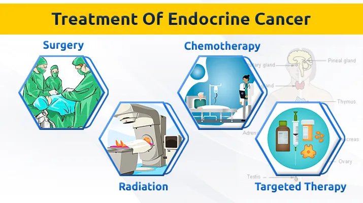 Treatment Of endocrine Cancer