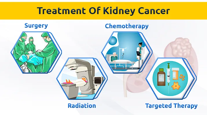 Treatment Of Pharynx Cancer Treatment Of Pharynx Cancer