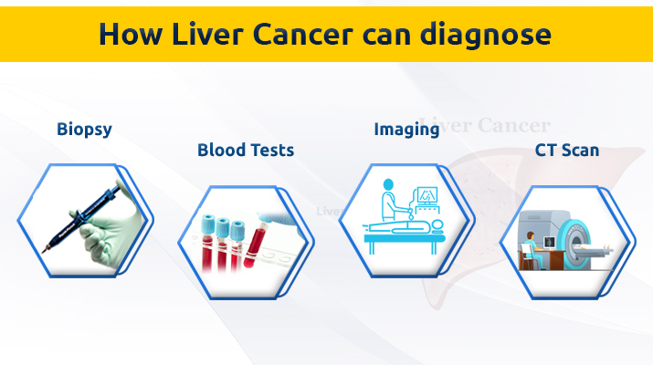 Liver Cancer Treatment In Pune Prolife Cancer Centre