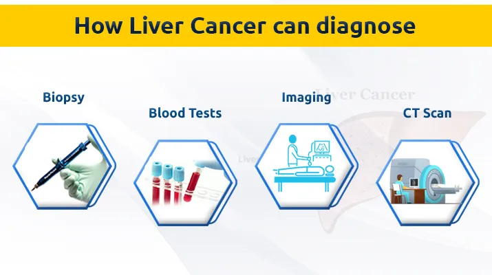 liver-cancer (4)