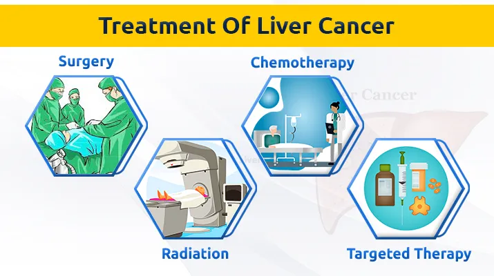 liver-cancer (5)