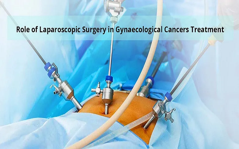 General Laparoscopic 1