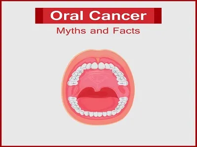 Oral Cancer feature image 1