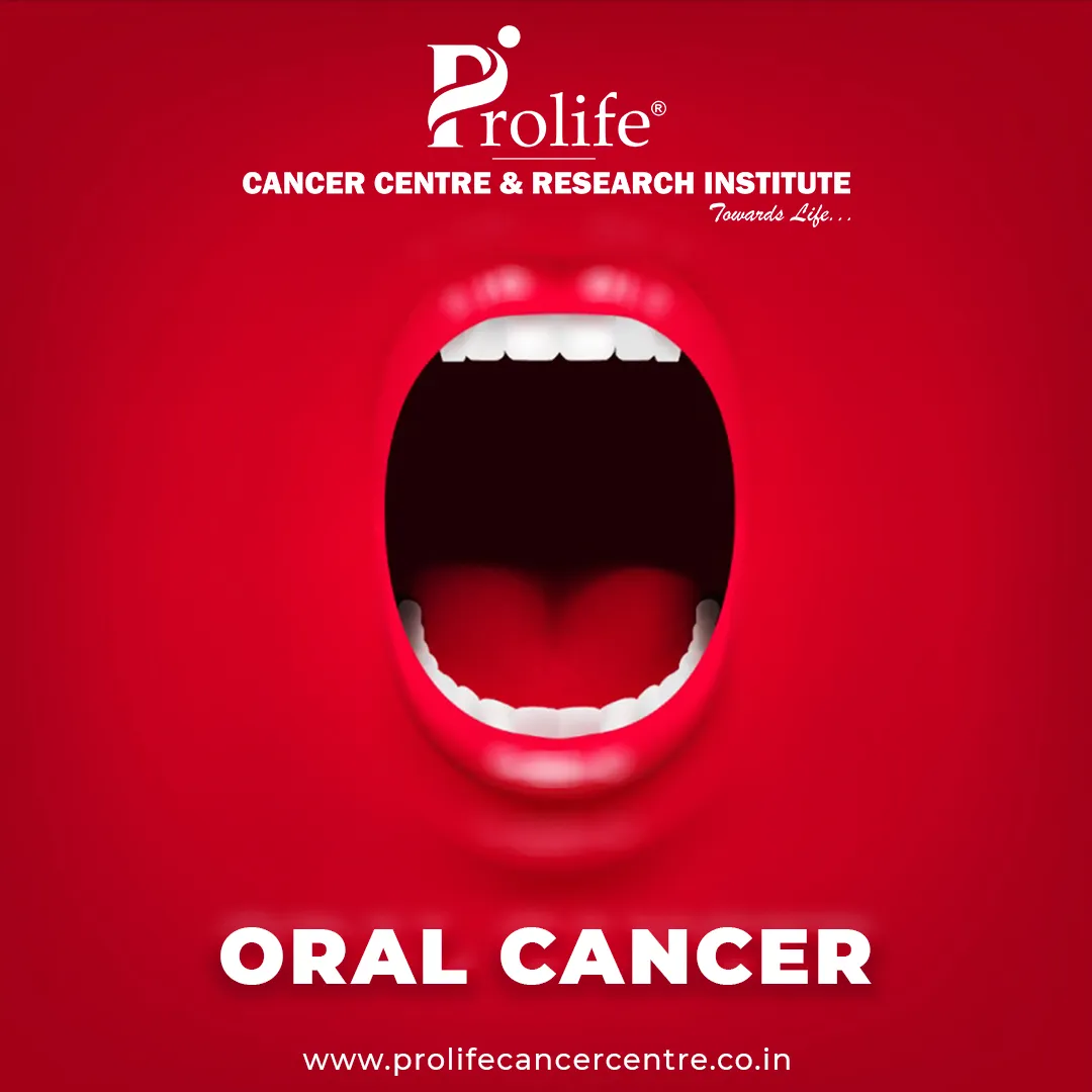 Oral Cancer