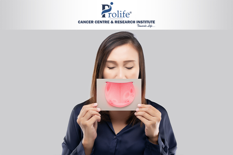 Best Cancer Clinic to cure Mouth Cancer in Pune