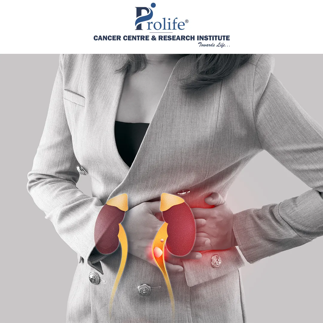 Kidney Cancer