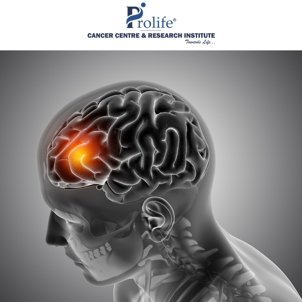 Effects of Alcohol on Tumour Growth, Metastasis, Immune Response, and Host Survival