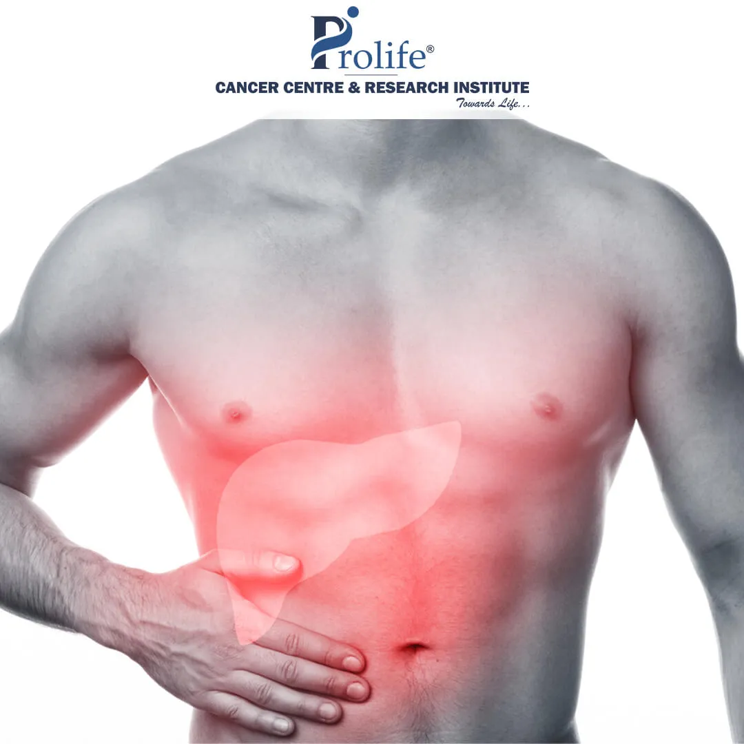 Gallbladder Cancer 1