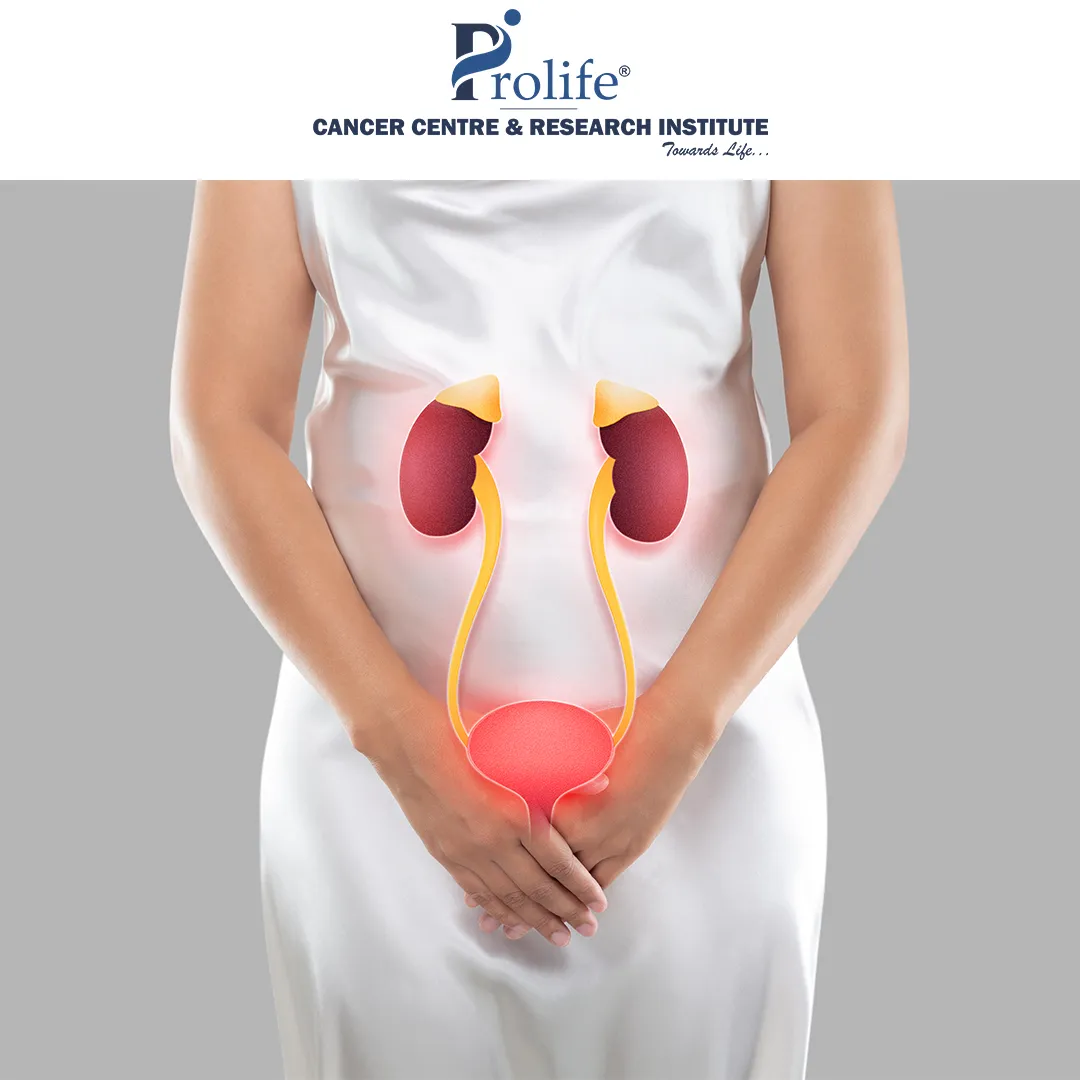 Kidney Cancer Treatment