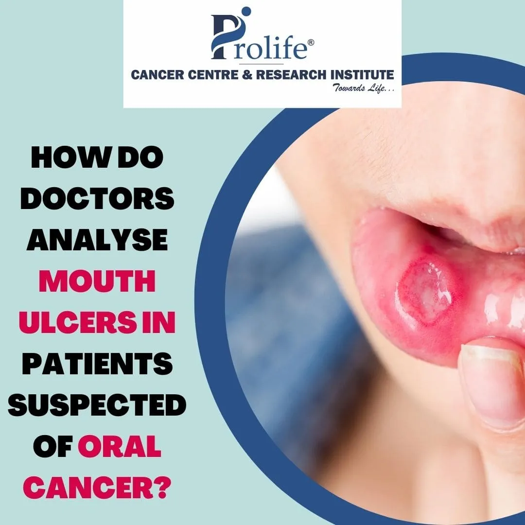 Mouth cancer treatment in Pune min