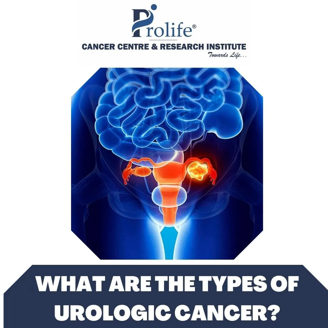 Urological cancer treatment in Pune min min