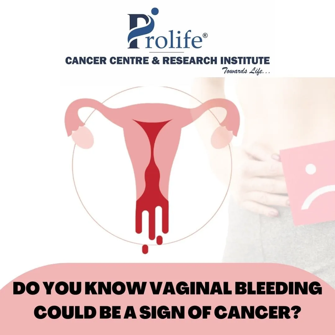 Vaginal Cancer Treatment in Pune min 1