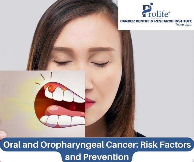 Oral and Oropharyngeal Cancer : Risk Factors and Prevention