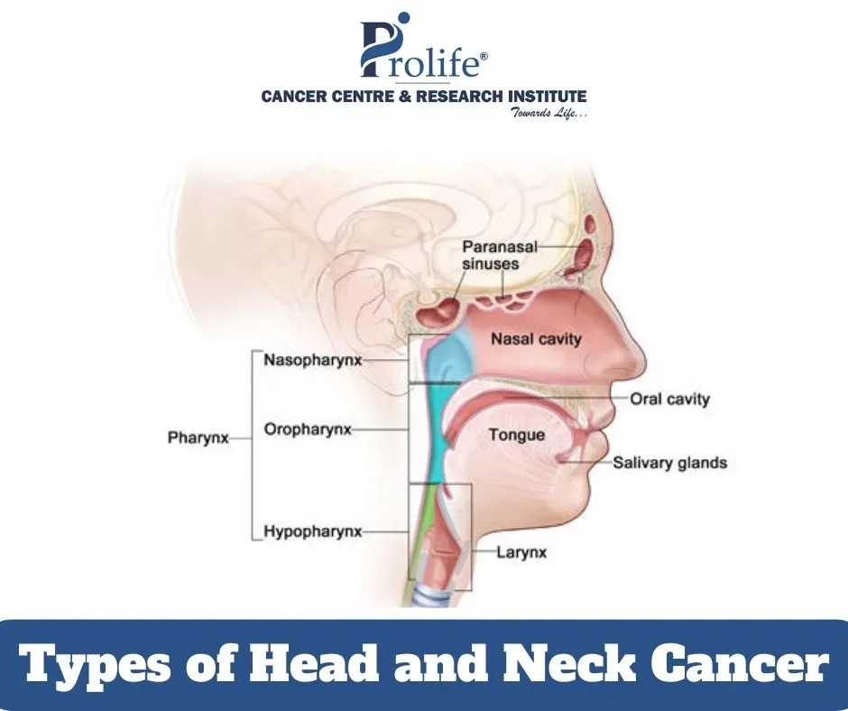 Types of Head and Neck Cancers Prolife Cancer Centre