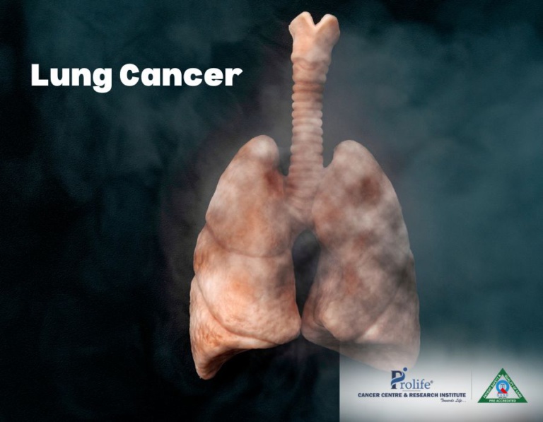 Lung Cancer Symptoms and Causes | Dr. Sumit Shah