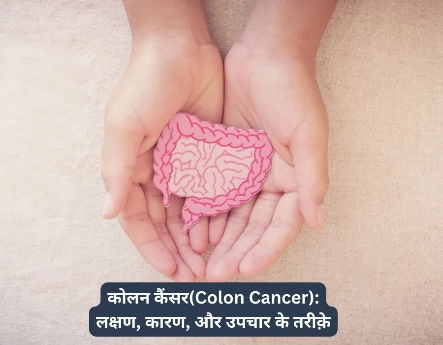 Colon Cancer लक्षण कारण और उपचार के तरीक़े