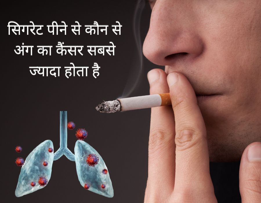 सिगरेट पीने से कौन से अंग का कैंसर सबसे ज्यादा होता है | Treatment Of Lungs Cancer | Cigarette Smoking | Cancer Caused by Cigarette Smoking