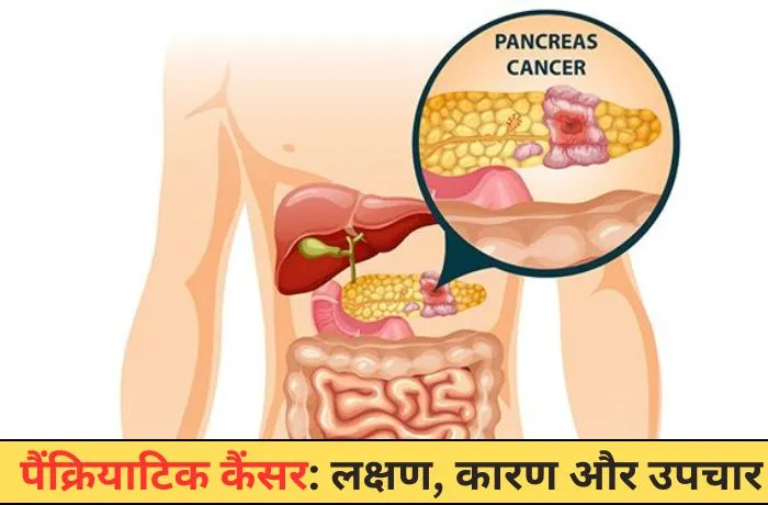 कैंसर लक्षण कारण और उपचार