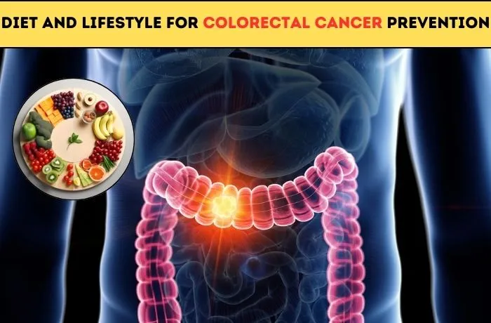 Diet and Lifestyle for Colorectal Cancer Prevention