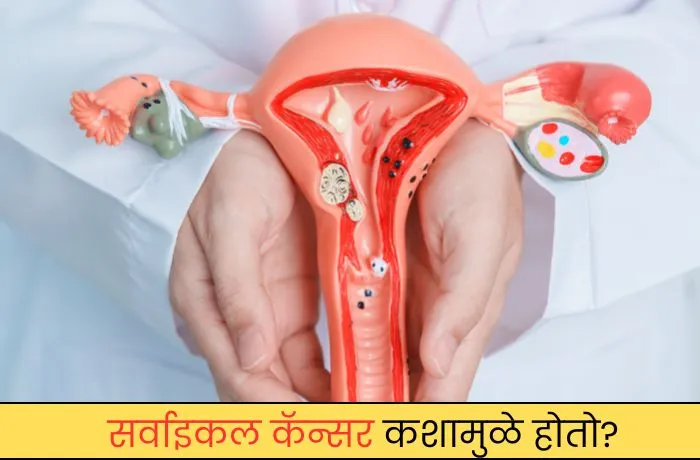 कशामुळे होतो कारण लक्षण आणि उपचार