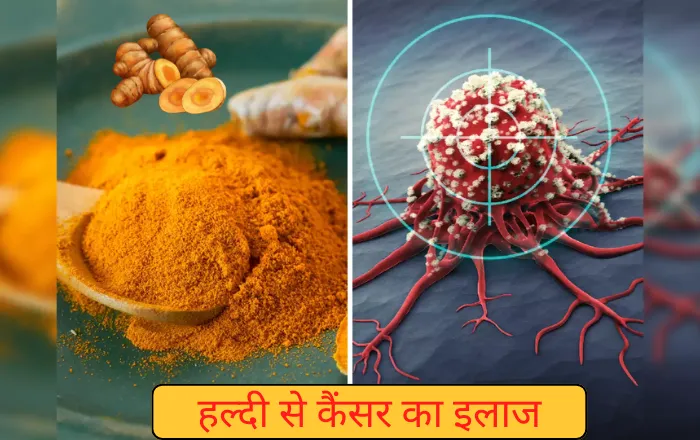 कैंसर का इलाज