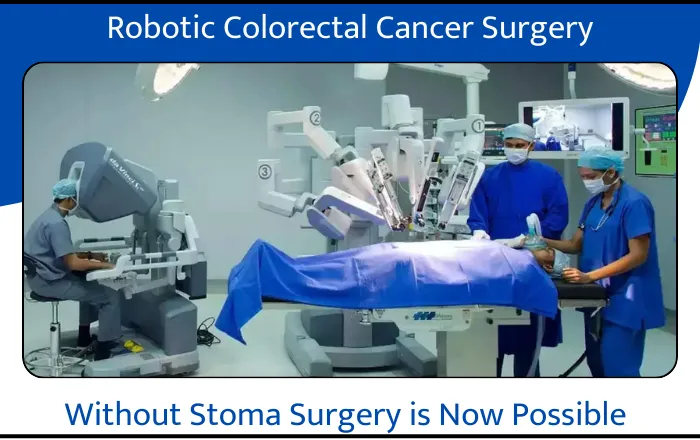 Robotic Colorectal Cancer Surgery A Revolutionary Approach 1
