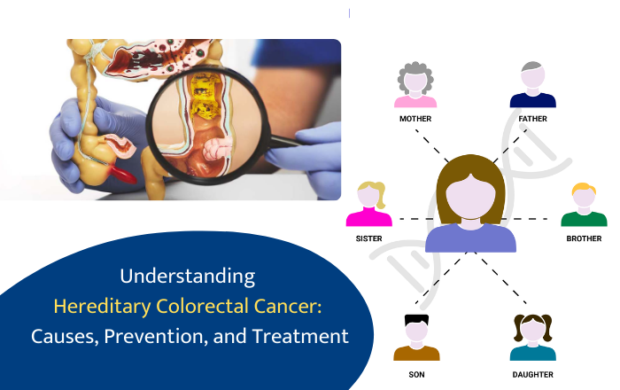 Understanding Hereditary Colorectal Cancer: Causes, Prevention, and Treatment